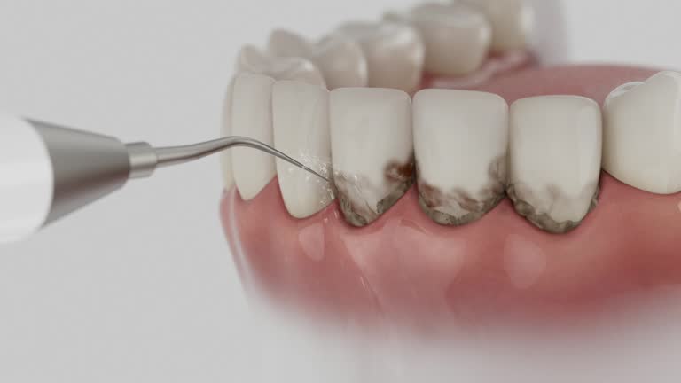 Trusted Tooth Extraction service in Muleshoe, TX - Dentist Open Now